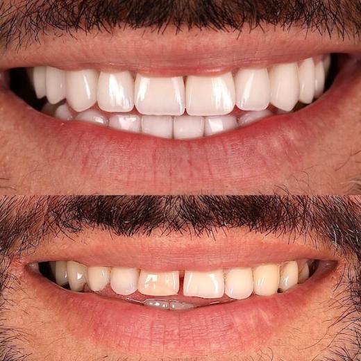 Cosmetic